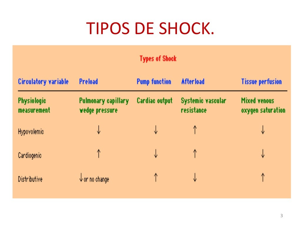 9 tipos de shock
