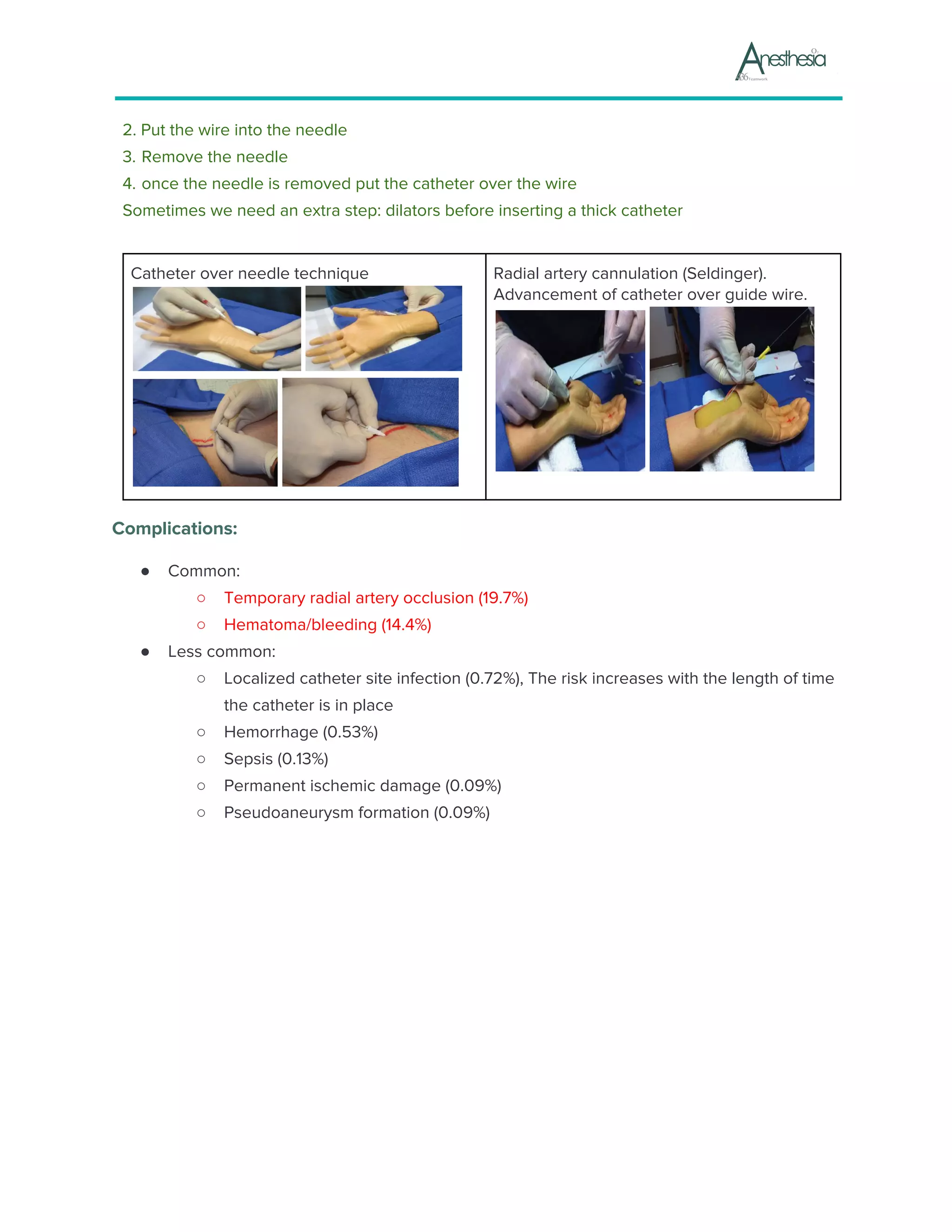 2. Put the wire into the needle
3.​ ​Remove the needle
4.​ ​once the needle is removed put the catheter over the wire
Sometimes we need an extra step: dilators before inserting a thick catheter
Catheter over needle technique Radial artery cannulation (Seldinger).
Advancement of catheter over guide wire.
Complications:
● Common:
○ Temporary radial artery occlusion (19.7%)
○ Hematoma/bleeding (14.4%)
● Less common:
○ Localized catheter site infection (0.72%), The risk increases with the length of time
the catheter is in place
○ Hemorrhage (0.53%)
○ Sepsis (0.13%)
○ Permanent ischemic damage (0.09%)
○ Pseudoaneurysm formation (0.09%)
 