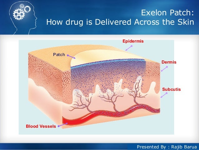 Dementia patches exelon