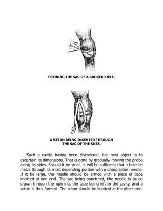 Seton Thread Probing An introduction to drip irrigation systems 1st ed Edition Singh | PDF