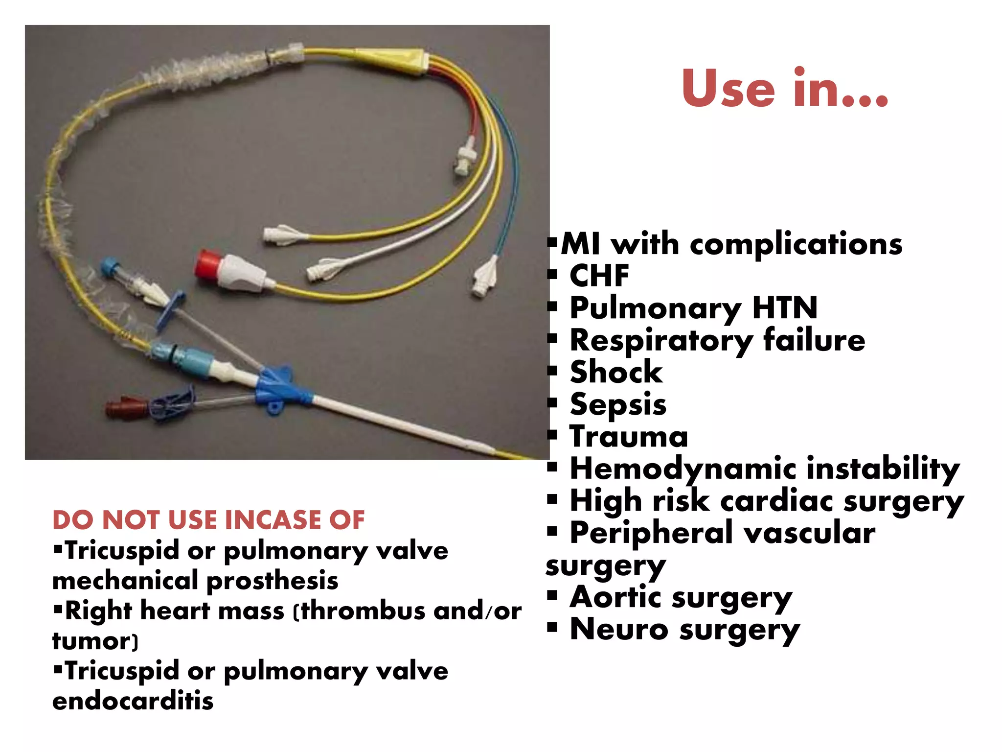 Use in…
MI with complications
 CHF
 Pulmonary HTN
 Respiratory failure
 Shock
 Sepsis
 Trauma
 Hemodynamic instability
 High risk cardiac surgery
 Peripheral vascular
surgery
 Aortic surgery
 Neuro surgery
DO NOT USE INCASE OF
Tricuspid or pulmonary valve
mechanical prosthesis
Right heart mass (thrombus and/or
tumor)
Tricuspid or pulmonary valve
endocarditis
 