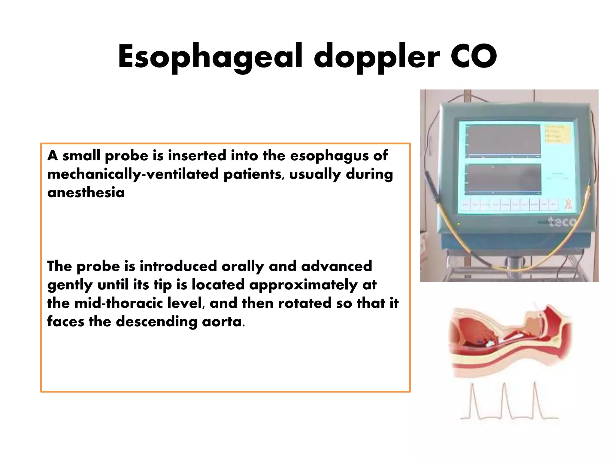 Esophageal doppler CO
A small probe is inserted into the esophagus of
mechanically-ventilated patients, usually during
anesthesia
The probe is introduced orally and advanced
gently until its tip is located approximately at
the mid-thoracic level, and then rotated so that it
faces the descending aorta.
 