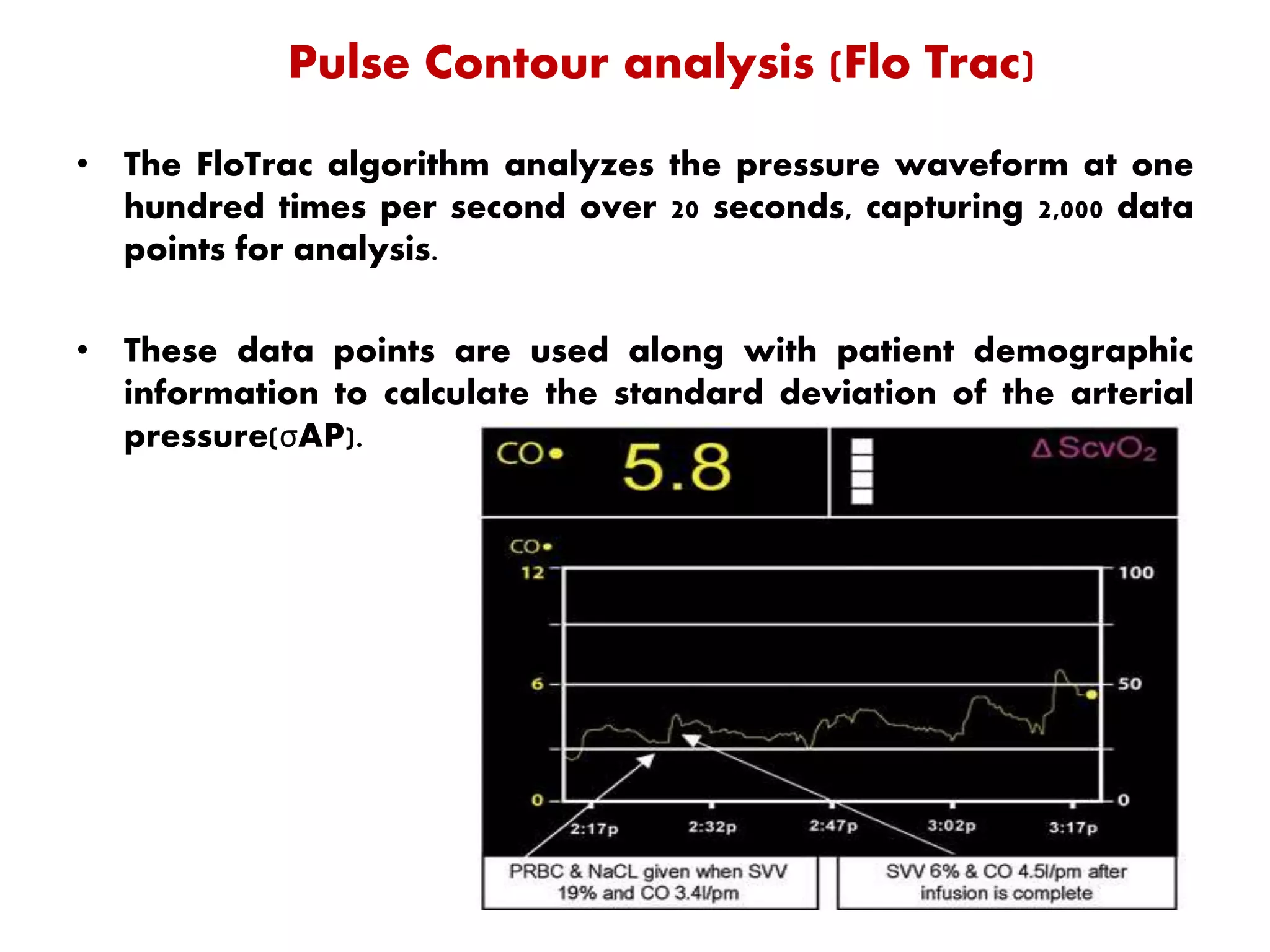 Pulse Contour analysis (Flo Trac)
• The FloTrac algorithm analyzes the pressure waveform at one
hundred times per second over 20 seconds, capturing 2,000 data
points for analysis.
• These data points are used along with patient demographic
information to calculate the standard deviation of the arterial
pressure(σAP).
 