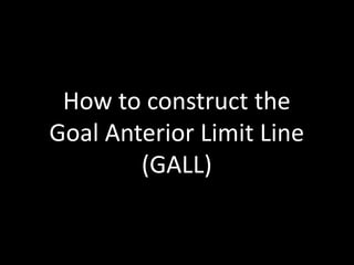 How to construct the
Goal Anterior Limit Line
(GALL)
 