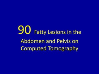 90 Fatty Lesions in the
Abdomen and Pelvis on
Computed Tomography
 