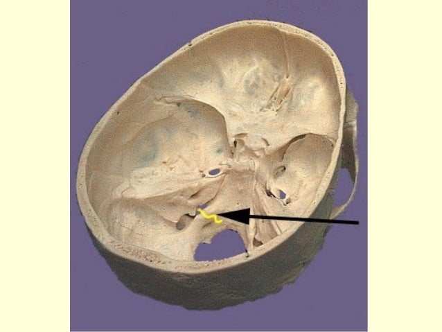 9, 10 & 11 cranial nerves