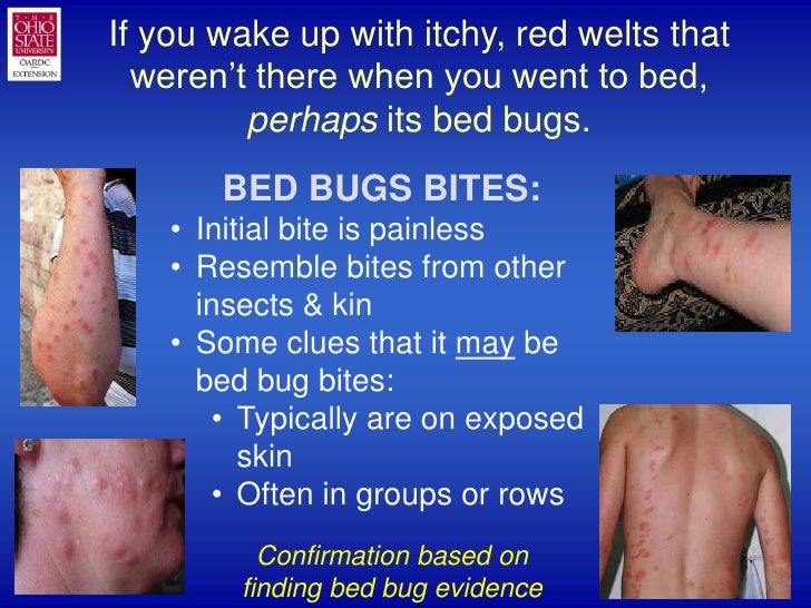 1 Bed Bugs 101