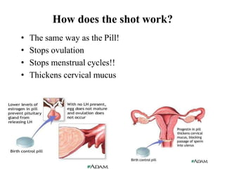 How does the shot work?
• The same way as the Pill!
• Stops ovulation
• Stops menstrual cycles!!
• Thickens cervical mucus
 