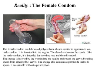 Reality : The Female Condom
The female condom is a lubricated polyurethane sheath, similar in appearance to a
male condom. It is inserted into the vagina. The closed end covers the cervix. Like
the male condom, it is intended for one-time use and then discarded.
The sponge is inserted by the woman into the vagina and covers the cervix blocking
sperm from entering the cervix. The sponge also contains a spermicide that kills
sperm. It is available without a prescription.
 