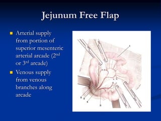 Jejunum Free Flap
 Arterial supply
from portion of
superior mesenteric
arterial arcade (2nd
or 3rd arcade)
 Venous supply
from venous
branches along
arcade
 