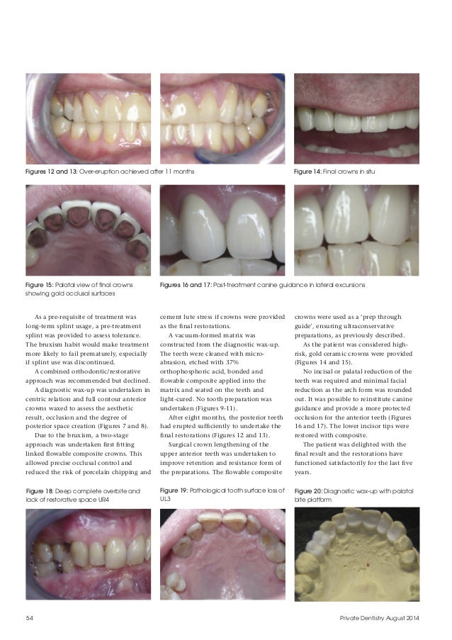 ToothSurfaceLoss_Part3