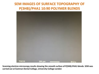 SEM IMAGES OF SURFACE TOPOGRAPHY OF
P(3HB)/PHA1 10:90 POLYMER BLENDS
Scanning electron microscopy results showing the smooth surface of P(3HB)-PHA1 blends. SEM was
carried out at Eastman Dental College, University College London
 