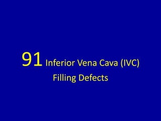 91Inferior Vena Cava (IVC)
Filling Defects
 