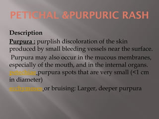 Pediatrics Dematology and rash in common conditiond.ppt