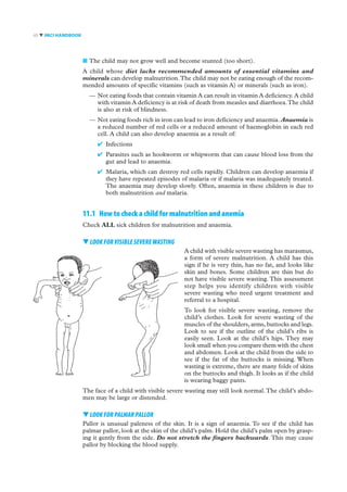 handbook IMCI - integrated management of childhood illness | PDF