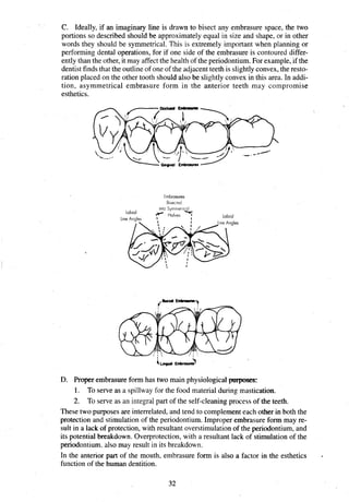 C. Ideally, if an imaginary line is drawn to bisect any embrasure space, the two
portions so described should be approximately equal in size and shape, or in other
words they should be symmetrical. This is extremely important when planning or
performing dental operations, for if one side of the embrasure is contoured differ-
ently than the other,it may affect the health of the periodontium.For example, if the
dentist findsthat the outline of one of the adjacentteeth is slightlyconvex, the resto-
ration placed on the other tooth should also be slightly convex in this area. In addi-
tion, asymmetrical embrasure form in the anterior teeth may compromise
esthetics.
Embrasures
B~sected
D. Proper embrasure form has two main physiological pmposes:
1. To serve as a spillway for the food material during mastication.
2. To serve as an integral part of the self-cleaningprocess of the teeth.
These two purposes are interrelated, and tend to complement each other in both the
protection and stimulation of the periodontium. Improper embrasure form may re-
sult in a lack of protection, with resultant overstimulationof the periodontium, and
its potential breakdown. Overprotection,with a resultant lack of stimulation of the
periodontium. also may result in its breakdown.
In the anterior part of the mouth, embrasure form is also a factor in the esthetics 4
function of the human dentition.
 