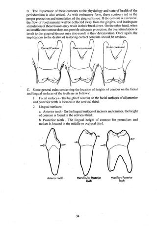 B. The importance of these contours to the physiology and state of health of the
periodontiurn is also critical. As with embrasure form, these contours aid in the
proper protection and stimulation of the gingival tissue. If the contour is excessive,
the flow of food material will be deflected away from the gingiva, and inadequate
stimulationof these tissues may result in their breakdown. On the other hand, when
an insufficientcontour does not provide adequateprotection,the overstirnulationor
insult to the gingival tissues may also result in their deterioration. Once again, the
implications to the dentist of restoring correct contours
- should be obvious.
C. Some general rules concerning the location of heights of contour on the facial
and lingual surfaces of the teeth are as follows:
1. Facial surfaces- The height of contour on the facial surfacesof all anterior
and posterior teeth is located in the cervical third.
2. Lingual surfaces:
a. Anteriorteeth - On the lingual surfaceof incisorsand canines,the height
of contour is found in the cervical third.
b. Posterior teeth - The lingual height of contour for premolars and
molars is located in the middle or occlusal third.
Anterior Tooth ~axillary
Posterior
Tooth Tooth
 