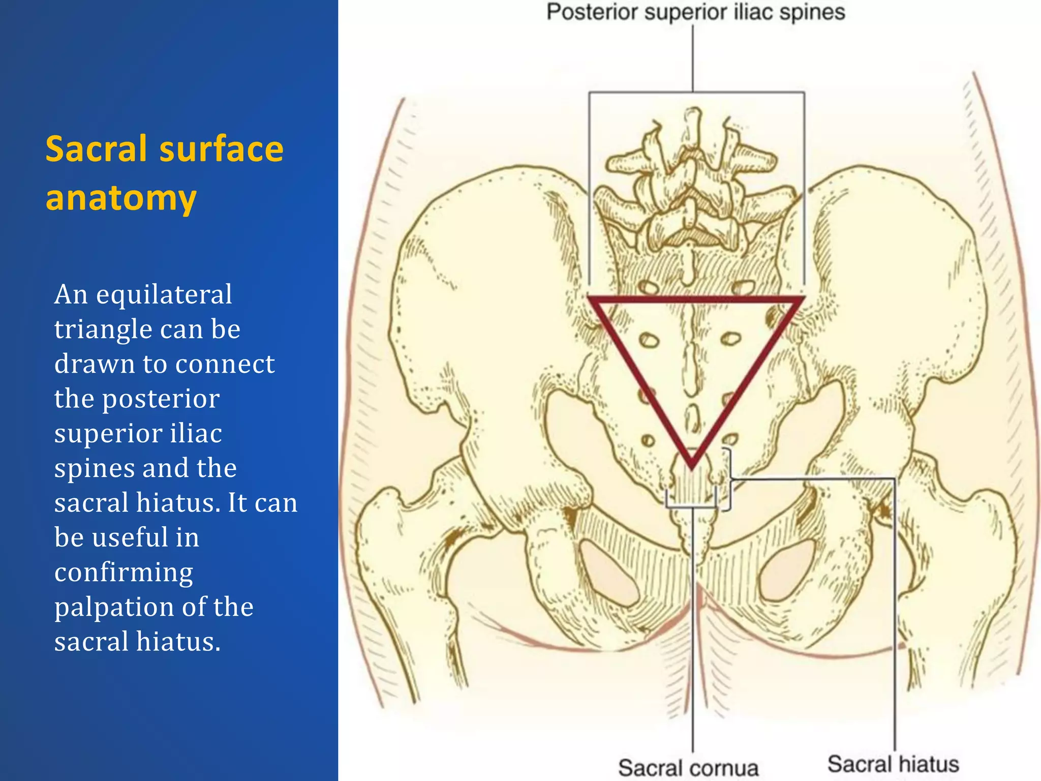 Spinal anesthesia (Anatomy and Pharmacology) | PPTX