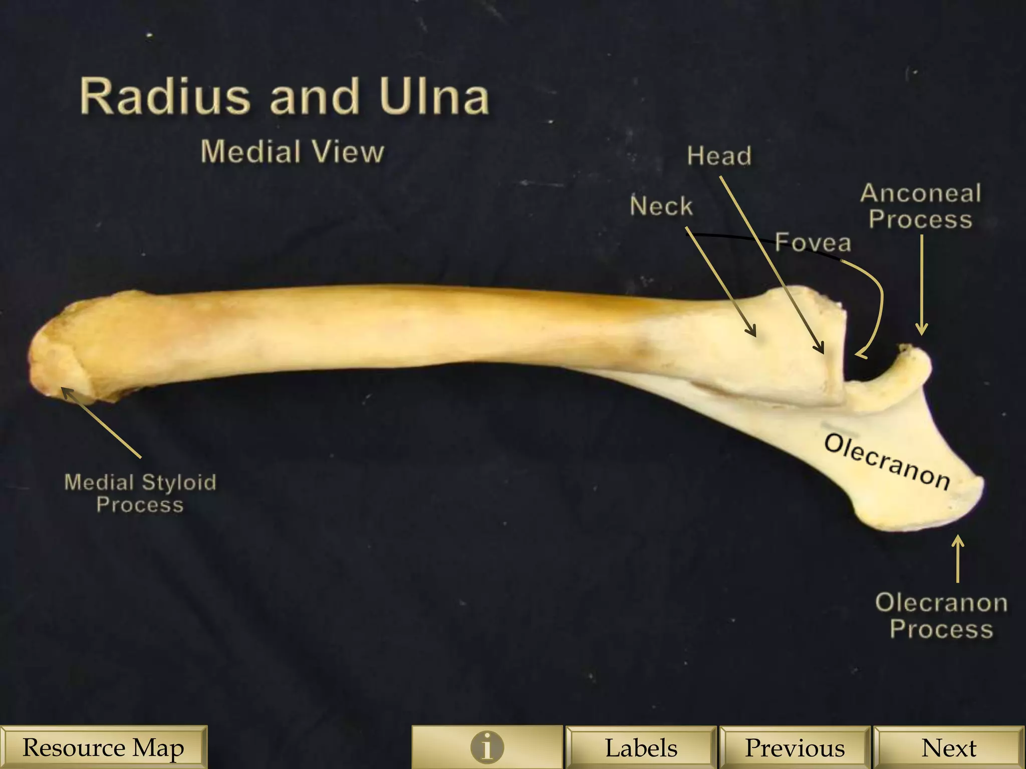 Resource Map   Labels   Previous   Next
 