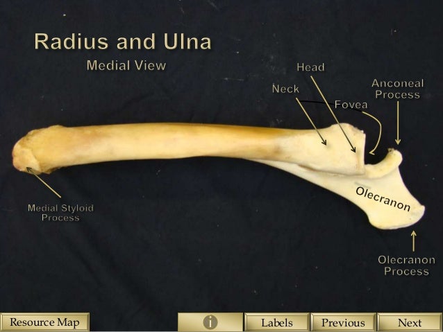 Skeletal structure of the Equine Forelimb