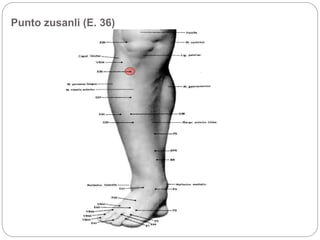 Punto zusanli (E. 36)
 