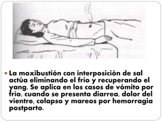  La moxibustión con interposición de sal
actúa eliminando el frío y recuperando el
yang. Se aplica en los casos de vómito por
frío, cuando se presenta diarrea, dolor del
vientre, colapso y mareos por hemorragia
postparto.
 