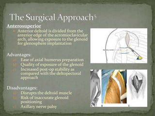 Anterosuperior
 Anterior deltoid is divided from the
anterior edge of the acromioclavicular
arch, allowing exposure to the glenoid
for glenosphere implantation
Advantages:
a) Ease of axial humerus preparation
b) Quality of exposure of the glenoid
c) Increased post-op stability as
compared with the deltopectoral
approach
Disadvantages:
a) Disrupts the deltoid muscle
b) Risk of inaccurate glenoid
positioning
c) Axillary nerve palsy
 