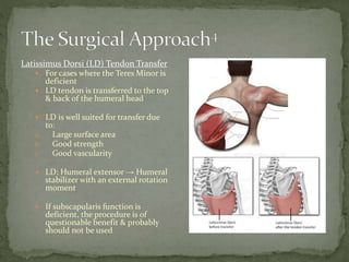 Latissimus Dorsi (LD) Tendon Transfer
 For cases where the Teres Minor is
deficient
 LD tendon is transferred to the top
& back of the humeral head
 LD is well suited for transfer due
to:
a. Large surface area
b. Good strength
c. Good vascularity
 LD: Humeral extensor → Humeral
stabilizer with an external rotation
moment
 If subscapularis function is
deficient, the procedure is of
questionable benefit & probably
should not be used
 