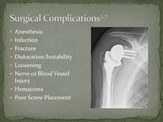  Anesthesia
 Infection
 Fracture
 Dislocation/Instability
 Loosening
 Nerve or Blood Vessel
Injury
 Hematoma
 Poor Screw Placement
 