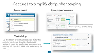 Features to simplify deep phenotyping
Smart search Smart measurements
Microcephaly [HP:0000252]
[...] The patient presents with osseous maturation
and mild intellectual disability. Craniofacial
features include flat nasal bridge, large ears, long
philtrum, micrognathia, loose skin, and a triangular
face. [...]
Text mining
 