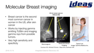 Molecular Breast imaging
•  Breast cancer is the second
most common cancer in
women in the US, after skin
cancer
•  Works by injecting gamma
emitting Tc99m and imaging
gamma rays from possible
tumors.
•  Very high sensitivity and
speciﬁcity
2016-10-19
 18
20	mm	cancer	seen	on	
MMG	&	MBI	
AddiBonal	10	mm	cancer	seen	
only	on	MBI	
Courtesy	of	Dr.	Michael	O’Connor.		Mayo	Clinic,	Rochester	USA	
Molecular	Breast	
Imaging	
Mammogram	 Typical	use	
Image:	Gamma	Medica	Inc.	
Integrated Detector Electronics AS
 