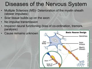 Diseases of the Nervous System
• Multiple Sclerosis (MS)- Deterioration of the myelin sheath
(slower impulses)
• Scar tissue builds up on the axon
• No impulse transmission
• Impared neural functioning (loss of co-ordination, tremors,
paralysis)
• Cause remains unknown
 