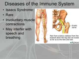 Diseases of the Immune System
• Isaacs Syndrome:
• Rare
• Involuntary muscle
contractions
• May interfer with
speech and
breathing
 