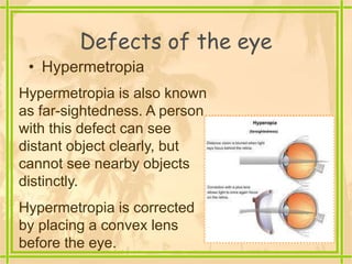 Defects of the eye
• Hypermetropia
Hypermetropia is also known
as far-sightedness. A person
with this defect can see
distant object clearly, but
cannot see nearby objects
distinctly.
Hypermetropia is corrected
by placing a convex lens
before the eye.
 