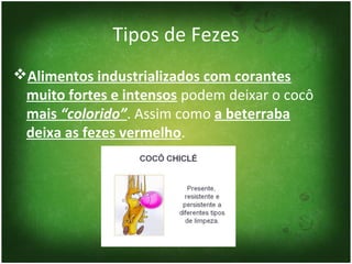 Tipos de Fezes
Alimentos industrializados com corantes
 muito fortes e intensos podem deixar o cocô
 mais “colorido”. Assim como a beterraba
 deixa as fezes vermelho.
 