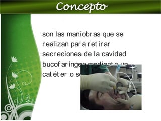son las maniobras que se
realizan para ret irar
secreciones de la cavidad
bucof aríngea mediant e un
cat ét er o sonda
 
