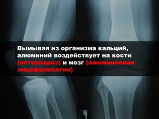 Смертельные банки