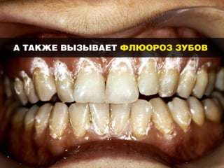 Смертельные банки