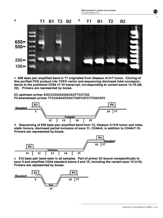 CD44 expression in prostate cancer invasion
AL Omara-Opyene et al
7
Laboratory Investigation (2004) 1–14
 