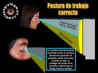 La cabeza está levemente
inclinada hacia el monitor.
Desde esa posición el
párpado cubre casi todo
el globo ocular, lo
protege del brillo de la
pantalla y disminuye la
fatiga visual y mental.
ZONA PROTEJIDA
POR EL PÁRPADO
ZONA
EXPUESTA
 