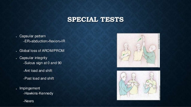 Shoulder Presentation - Internship II VA hospital (Acute care)