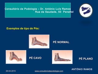 26-04-201526-04-2015 www.consultoriodepodologia.comwww.consultoriodepodologia.com
  
PÉ CAVOPÉ CAVO PÉ PLANOPÉ PLANO
PÉ NORMALPÉ NORMAL
Consultório de Podologia – Dr. António Luís Ramos
Rua da Saudade, 50 Penafiel
Exemplos de tipo de Pés:Exemplos de tipo de Pés:
ANTÓNIO RAMOS
 