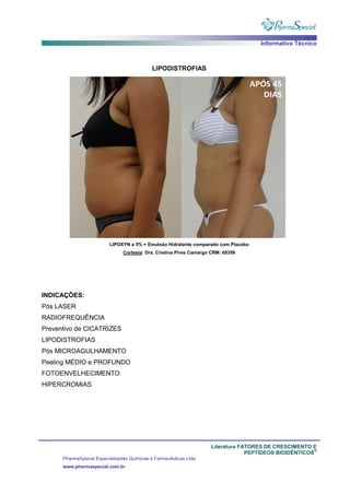 Informativo Técnico
Literatura FATORES DE CRESCIMENTO E
PEPTÍDEOS BIOIDÊNTICOS
®
PharmaSpecial Especialidades Químicas e Farmacêuticas Ltda
www.pharmaspecial.com.br
LIPODISTROFIAS
LIPOXYN a 5% + Emulsão Hidratante comparado com Placebo
Cortesia: Dra. Cristina Pires Camargo CRM: 65356
INDICAÇÕES:
Pós LASER
RADIOFREQUÊNCIA
Preventivo de CICATRIZES
LIPODISTROFIAS
Pós MICROAGULHAMENTO
Peeling MÉDIO e PROFUNDO
FOTOENVELHECIMENTO
HIPERCROMIAS
 