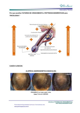 Informativo Técnico
Literatura FATORES DE CRESCIMENTO E
PEPTÍDEOS BIOIDÊNTICOS
®
PharmaSpecial Especialidades Químicas e Farmacêuticas Ltda
www.pharmaspecial.com.br
Por que escolher FATORES DE CRESCIMENTO e PEPTÍDEOS BIOIDÊNTICOS para
TRICOLOGIA ?
CASOS CLÍNICOS:
ALOPÉCIA ANDROGENÉTICA MASCULINA
PROHAIRIN 5% em loção capilar 1x/dia.
Fonte: Protocolo CAREGEN
 