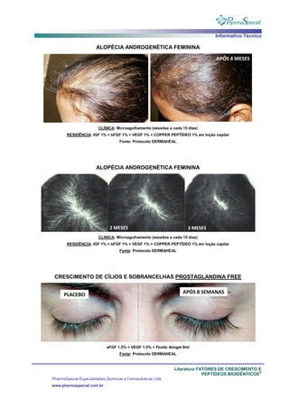 Informativo Técnico
Literatura FATORES DE CRESCIMENTO E
PEPTÍDEOS BIOIDÊNTICOS
®
PharmaSpecial Especialidades Químicas e Farmacêuticas Ltda
www.pharmaspecial.com.br
ALOPÉCIA ANDROGENÉTICA FEMININA
CLÍNICA: Microagulhamento (sessões a cada 15 dias)
RESIDÊNCIA: IGF 1% + bFGF 1% + VEGF 1% + COPPER PEPTÍDEO 1% em loção capilar
Fonte: Protocolo DERMAHEAL
ALOPÉCIA ANDROGENÉTICA FEMININA
CLÍNICA: Microagulhamento (sessões a cada 15 dias)
RESIDÊNCIA: IGF 1% + bFGF 1% + VEGF 1% + COPPER PEPTÍDEO 1% em loção capilar
Fonte: Protocolo DERMAHEAL
CRESCIMENTO DE CÍLIOS E SOBRANCELHAS PROSTAGLANDINA FREE
aFGF 1,5% + VEGF 1,5% + Fluido Amigel 8ml
Fonte: Protocolo DERMAHEAL
 