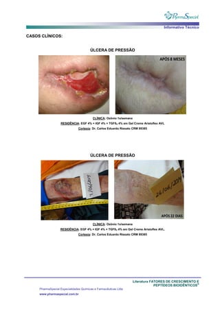 Informativo Técnico
Literatura FATORES DE CRESCIMENTO E
PEPTÍDEOS BIOIDÊNTICOS
®
PharmaSpecial Especialidades Químicas e Farmacêuticas Ltda
www.pharmaspecial.com.br
CASOS CLÍNICOS:
ÚLCERA DE PRESSÃO
CLÍNICA: Ozônio 1x/semana
RESIDÊNCIA: EGF 4% + IGF 4% + TGFß3 4% em Gel Creme Aristoflex AVL
Cortesia: Dr. Carlos Eduardo Rissato CRM 89385
ÚLCERA DE PRESSÃO
CLÍNICA: Ozônio 1x/semana
RESIDÊNCIA: EGF 4% + IGF 4% + TGFß3 4% em Gel Creme Aristoflex AVL.
Cortesia: Dr. Carlos Eduardo Rissato CRM 89385
 