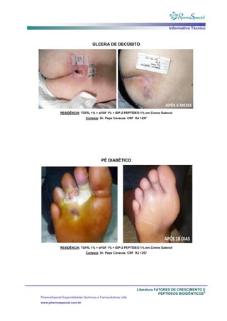 Informativo Técnico
Literatura FATORES DE CRESCIMENTO E
PEPTÍDEOS BIOIDÊNTICOS
®
PharmaSpecial Especialidades Químicas e Farmacêuticas Ltda
www.pharmaspecial.com.br
ÚLCERA DE DECÚBITO
RESIDÊNCIA: TGFß3 1% + aFGF 1% + IDP-2 PEPTÍDEO 1% em Creme Galenol
Cortesia: Dr. Pepe Cavacas CRF RJ 1257
PÉ DIABÉTICO
RESIDÊNCIA: TGFß3 1% + aFGF 1% + IDP-2 PEPTÍDEO 1% em Creme Galenol
Cortesia: Dr. Pepe Cavacas CRF RJ 1257
 