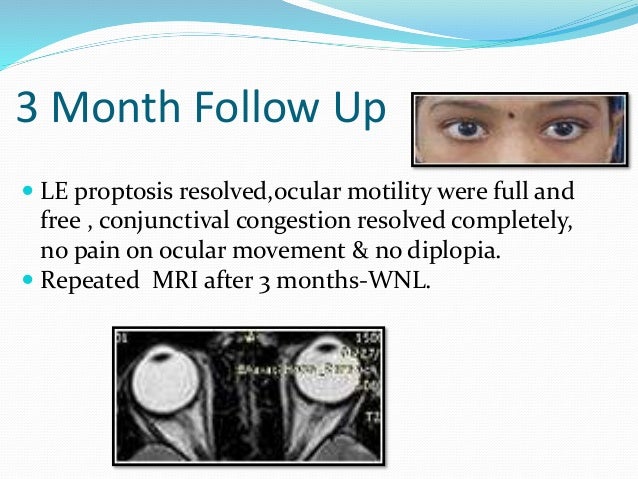 Orbital Myositis: A Case Report