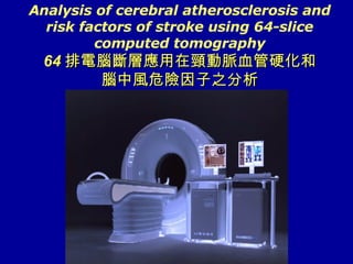 Analysis of cerebral atherosclerosis and risk factors of stroke using 64-slice computed tomography 64 排電腦斷層應用在頸動脈血管硬化和 腦中風危險因子之分析 