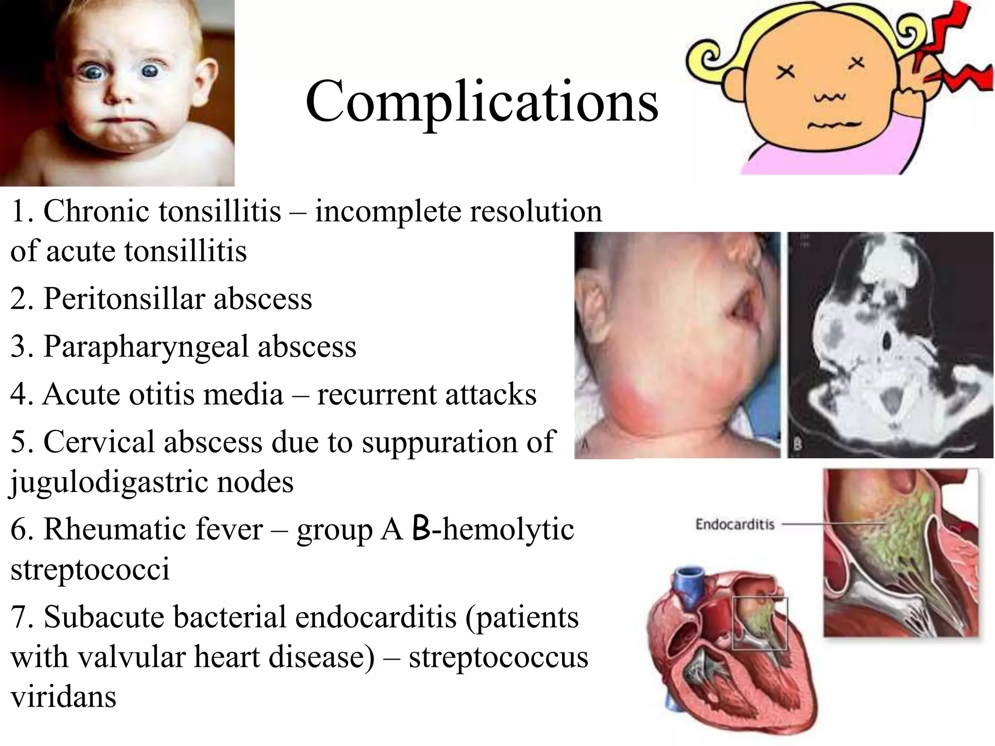 Complications
1. Chronic tonsillitis – incomplete resolution
of acute tonsillitis
2. Peritonsillar abscess
3. Parapharyngeal abscess
4. Acute otitis media – recurrent attacks
5. Cervical abscess due to suppuration of
jugulodigastric nodes
6. Rheumatic fever – group A B-hemolytic
streptococci
7. Subacute bacterial endocarditis (patients
with valvular heart disease) – streptococcus
viridans
 